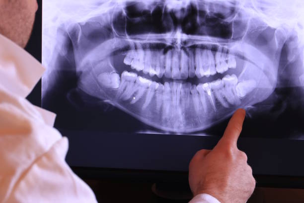 Best 24-Hour Emergency Dentist in Cleveland, TX