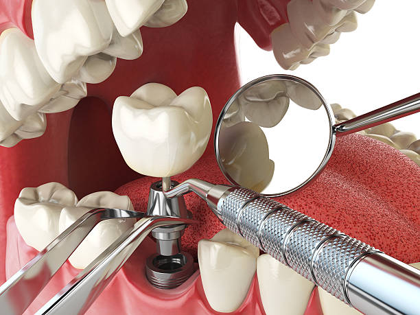 Best Emergency Dental Surgery in Cleveland, TX